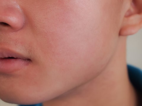 Dermatologist recommended For daily use Oil free formula after