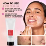 COSRX Salicylic Acid Daily Gentle Cleanser 150mL – Acne Control Korean Face Wash